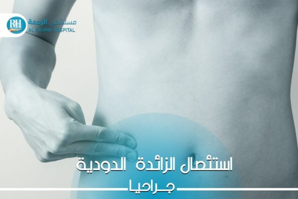 عملية الزائدة الدودية