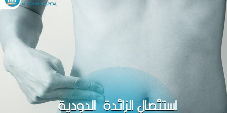 عملية الزائدة الدودية