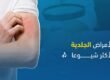 الأمراض الجلدية الشائعة