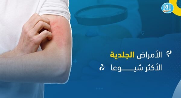 الأمراض الجلدية الشائعة