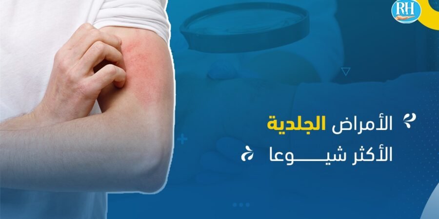 الأمراض الجلدية الشائعة