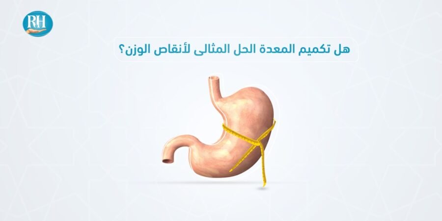 تكميم المعدة - مستشفى الرحمة