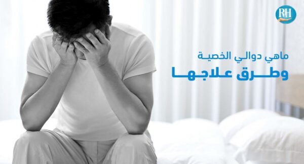دوالي الخصية دوالي الخصية