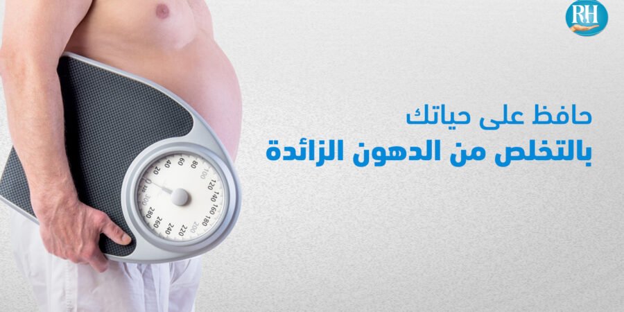 السمنة المفرطة