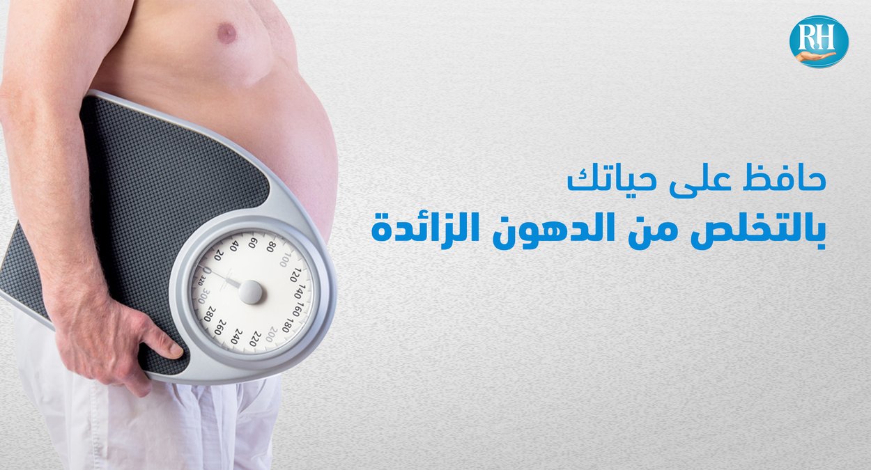 السمنة المفرطة السمنة المفرطة